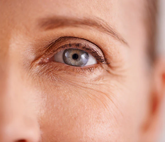 fine_lines_and_wrinkles - balancedaestheticsmedspa.com