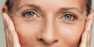 Why We Use Both Hyaluronic Acid & Calcium-Based Fillers