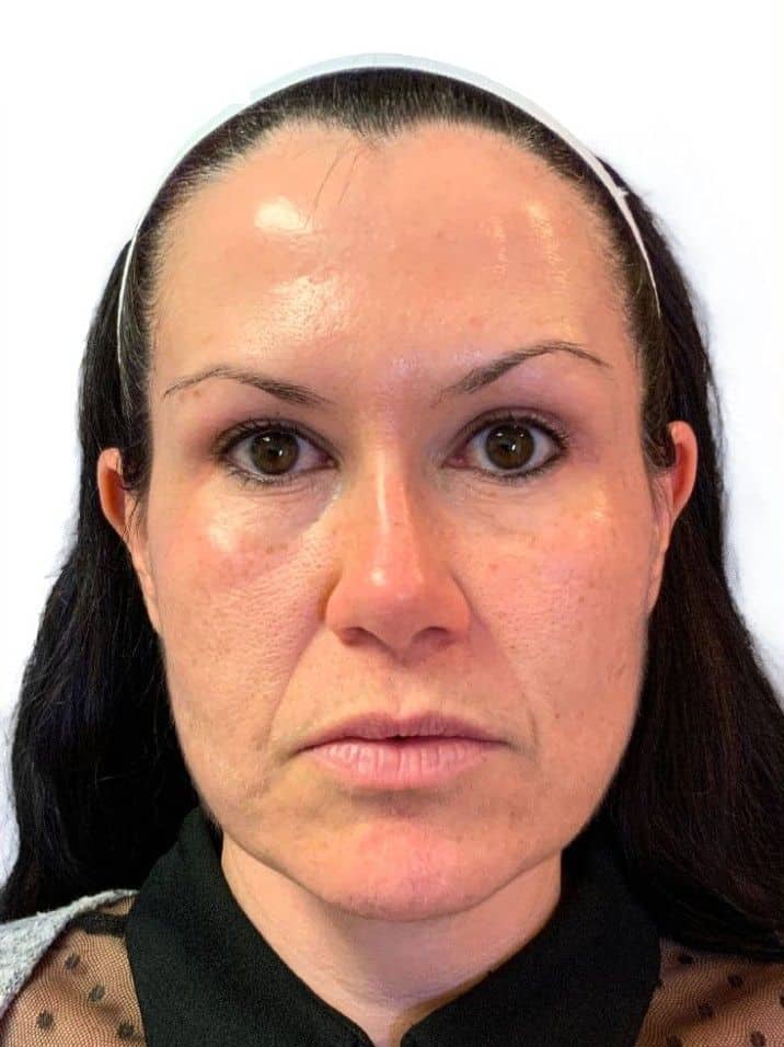 Close-up of a woman with clear skin and dark hair, looking directly at the camera.