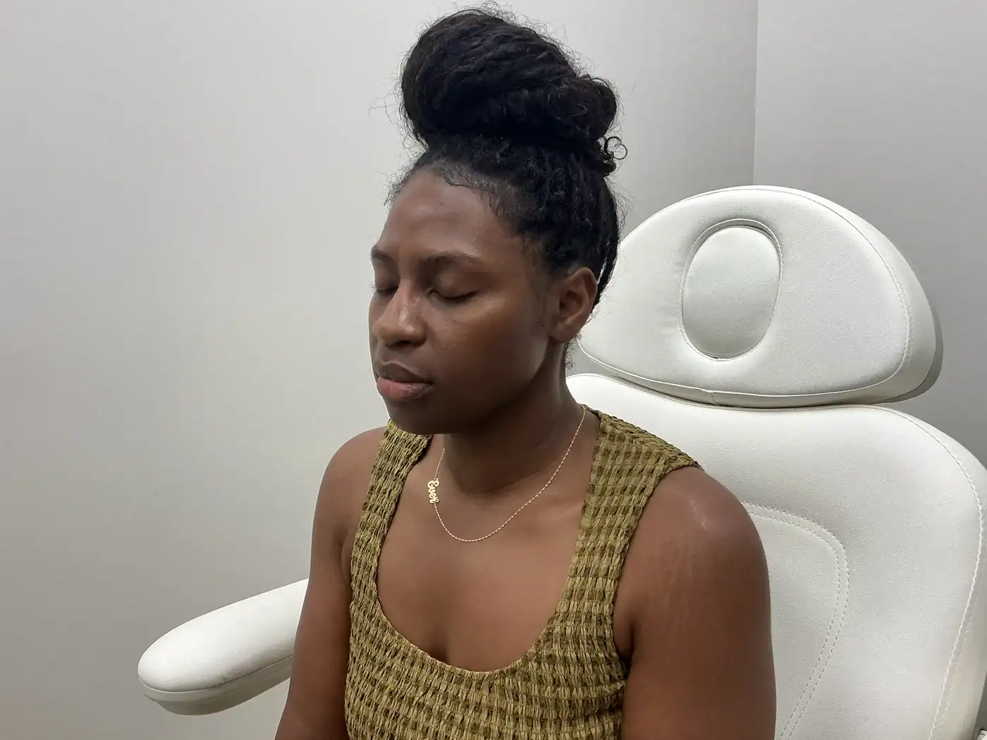 Patient before cheek and chin filler at Balanced Aesthetics + Wellness