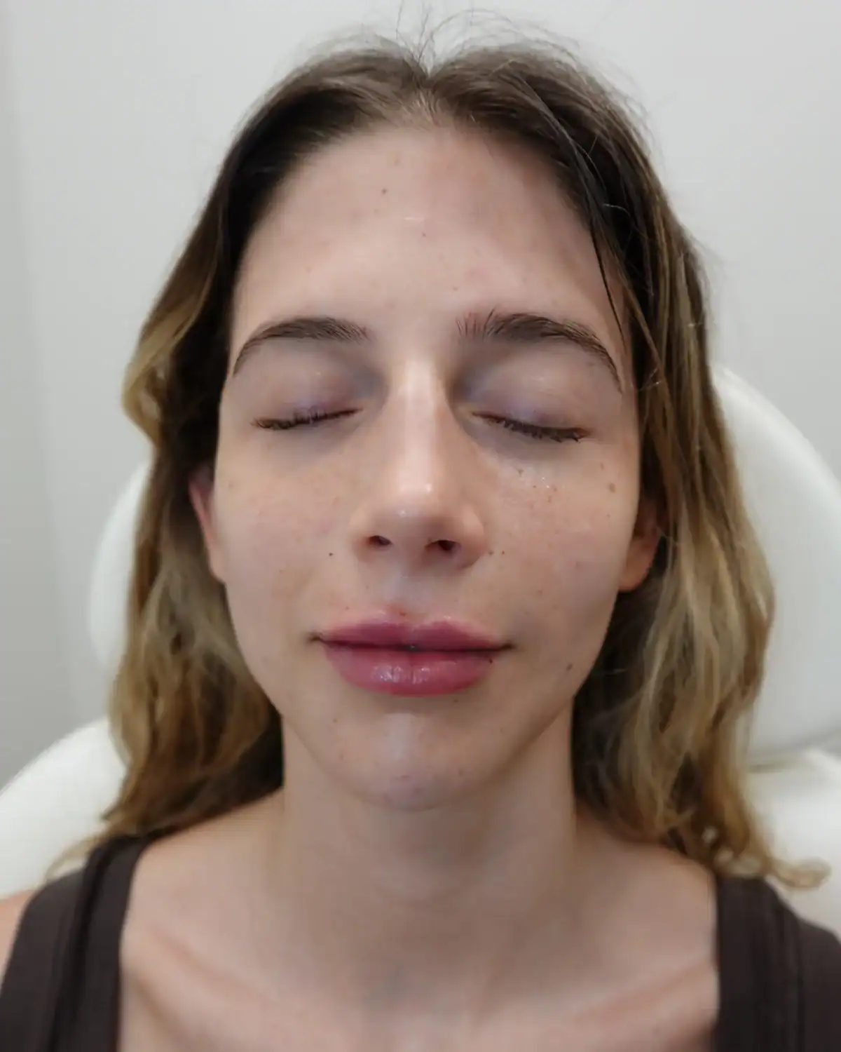 Close-up of a woman with clear skin and relaxed expression in a skincare clinic.