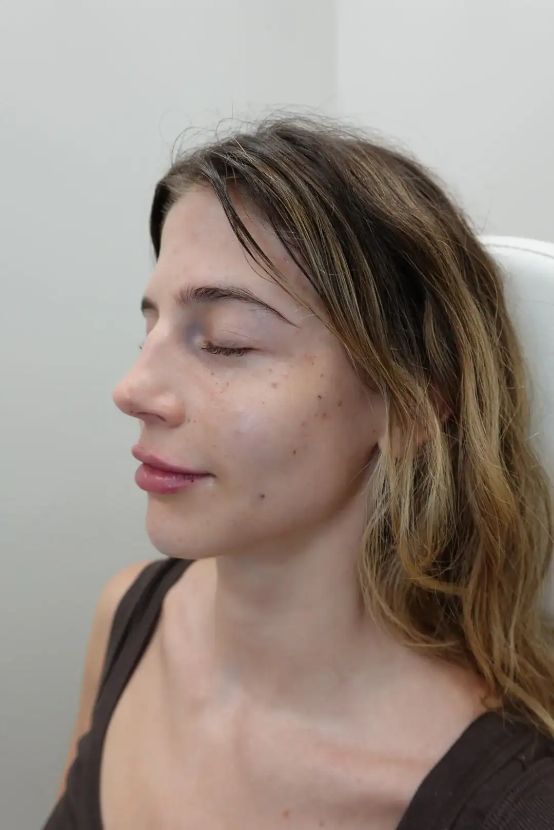 Close-up of a woman with clear skin and freckles during skincare consultation.